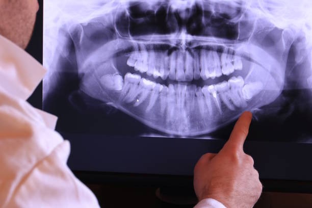 Best Urgent Care for Lost Fillings or Crowns in Eastover, NC