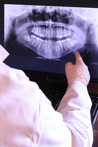 Best Emergency Root Canal Treatment in Eastover, NC