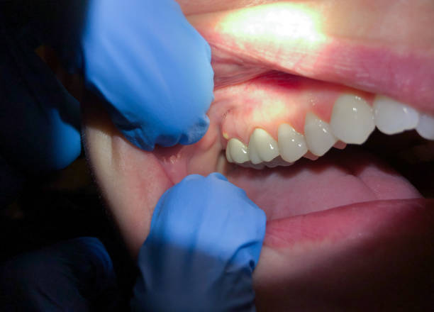 Best Same-Day Emergency Dental Services in Eastover, NC