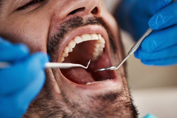Best Cosmetic Emergency Dentistry in Eastover, NC